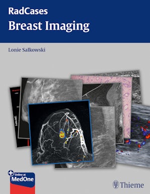 Radcases Breast Imaging