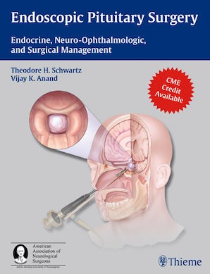 Endoscopic Pituitary Surgery