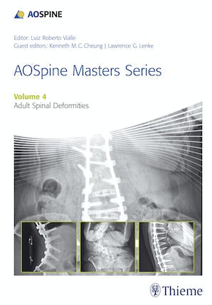 AOSpine Master Series, Vol. 4: Adult Spinal Deformities