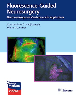 Fluorescence-Guided Neurosurgery