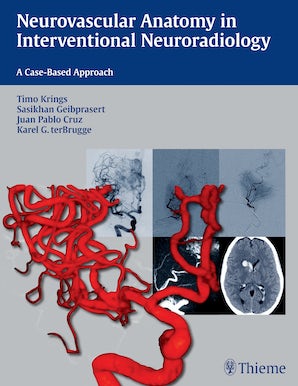 Neurovascular Anatomy in Interventional Neuroradiology