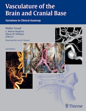 Vasculature of the Brain and Cranial Base