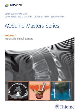 AOSpine Masters Series, Volume 1: Metastatic Spinal Tumors