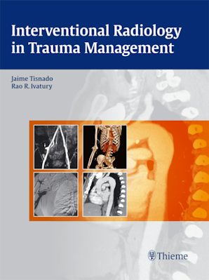 Interventional Radiology in Trauma Management