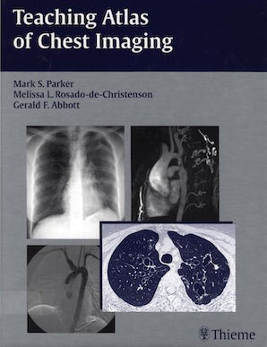 Teaching Atlas of Chest Imaging