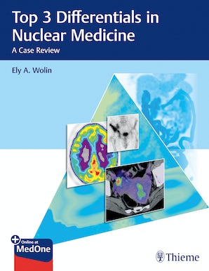 Top 3 Differentials in Nuclear Medicine