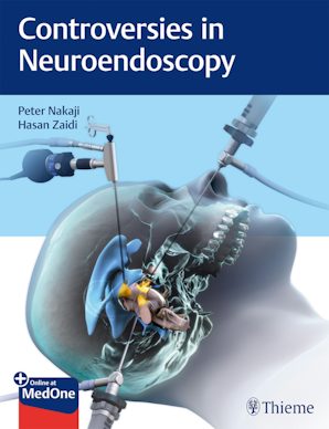 Controversies in Neuroendoscopy