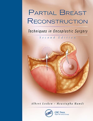 Partial Breast Reconstruction