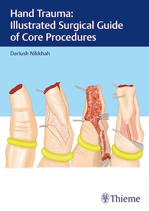 Hand Trauma: Illustrated Surgical Guide of Core Procedures