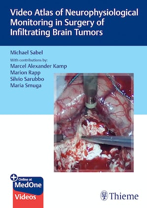 Video Atlas of Neurophysiological Monitoring in Surgery of Infiltrating Brain Tumors