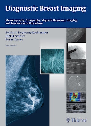 Diagnostic Breast Imaging
