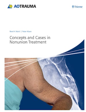 Concepts and Cases in Nonunion Treatment