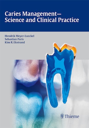Caries Management - Science and Clinical Practice