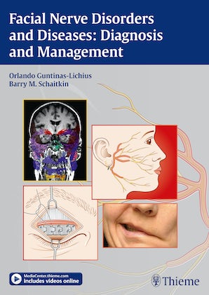 Facial Nerve Disorders and Diseases: Diagnosis and Management