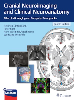 Cranial Neuroimaging and Clinical Neuroanatomy
