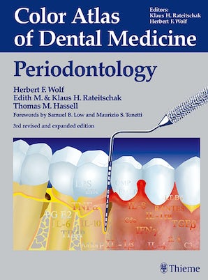 Color Atlas of Dental Medicine: Periodontology