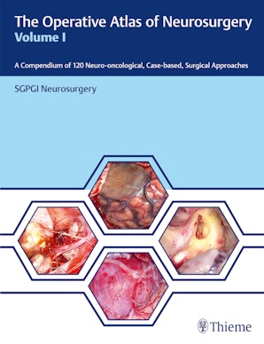 The Operative Atlas of Neurosurgery, Vol I