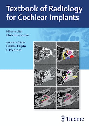 Textbook of Radiology for Cochlear Implants